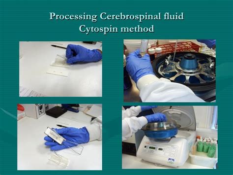 cytospin technique